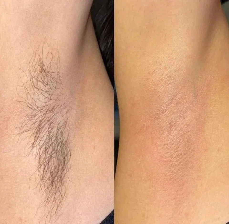Strawberry Painless Cream Wax With Wax Strips