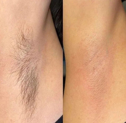 Strawberry Painless Cream Wax With Wax Strips
